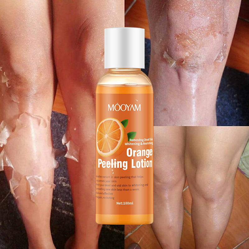Orange Peel Lotion Peeling Oil Body Lotion Gentle Exfoliation Orange Peel Lotion Peeling Oil Body Lotion Gentle Exfoliation